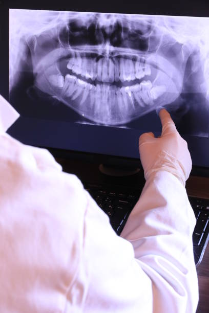 Best Emergency Tooth Extraction in Essex Fells, NJ